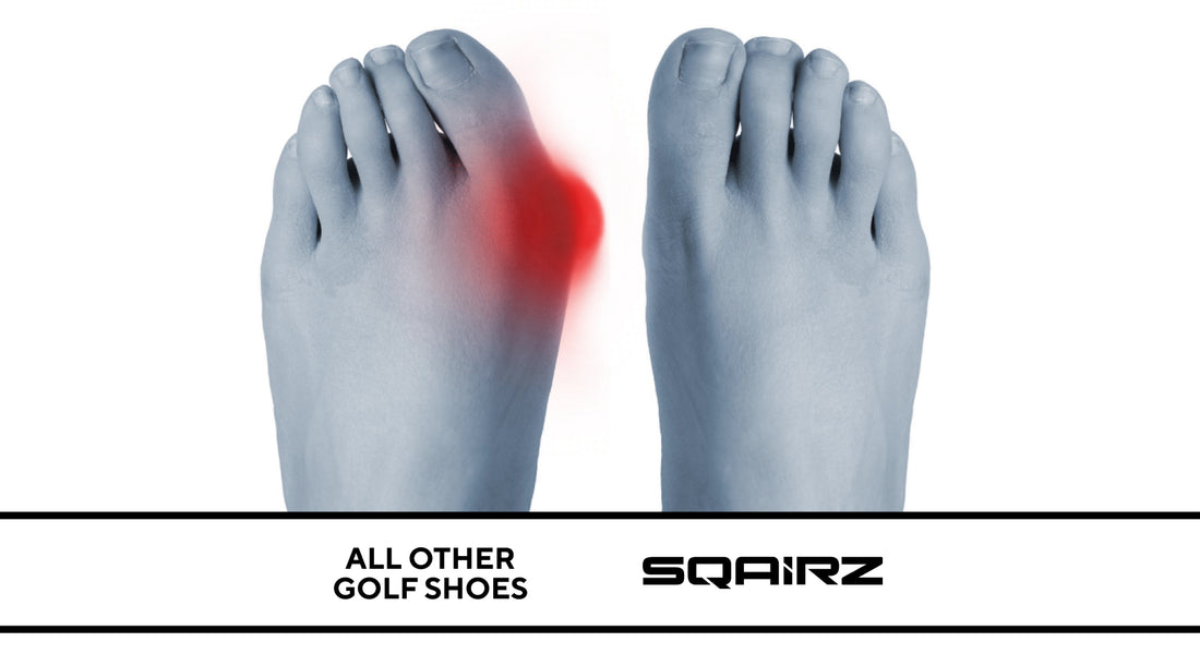 Foot problems? You need SQAIRZ.