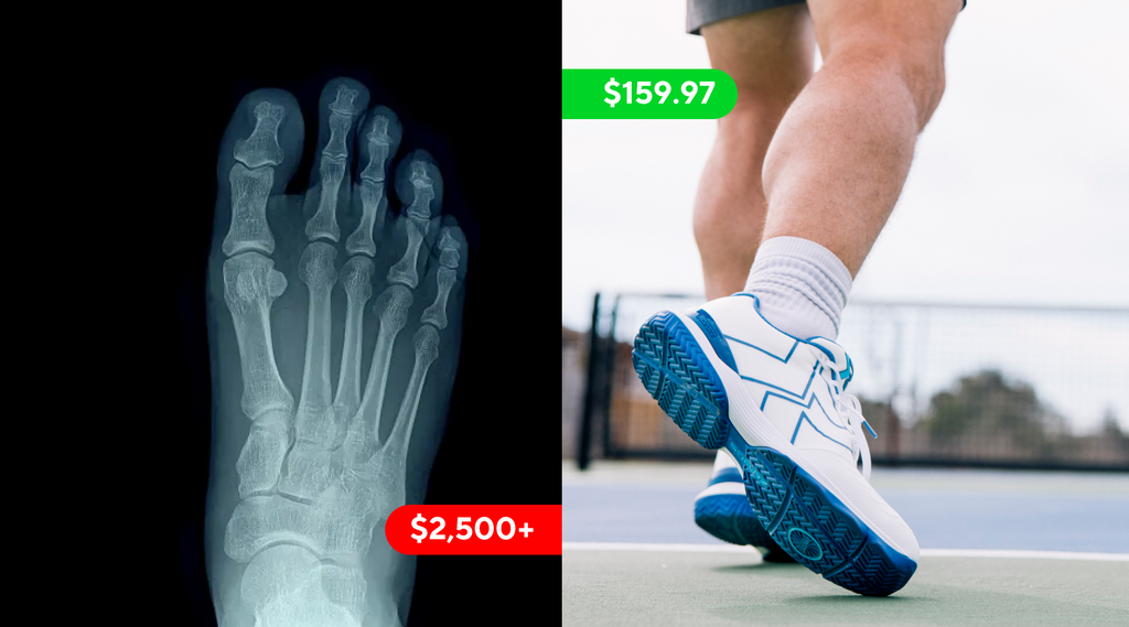 The Most Preventable Pickleball Injury Is Also the Most Common